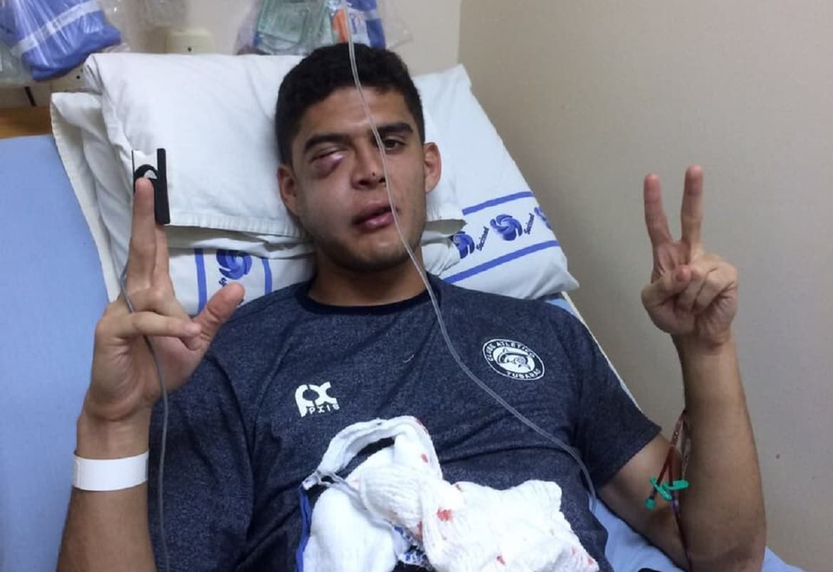 Após chute de atacante, goleiro do Tubarão fratura maxilar e pode ficar seis meses longe dos gramados