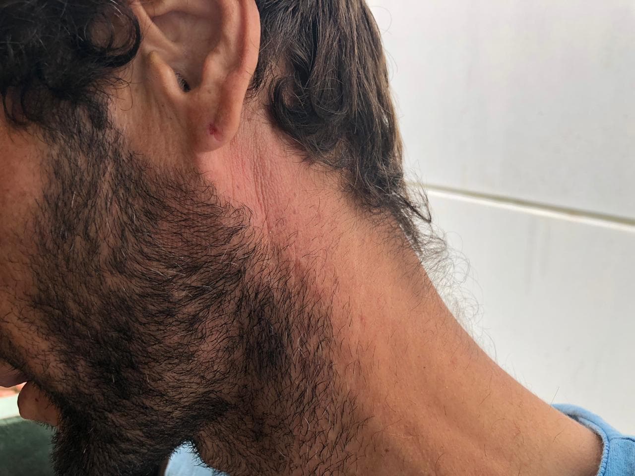Homem acusa segurança de atacadista de agressão