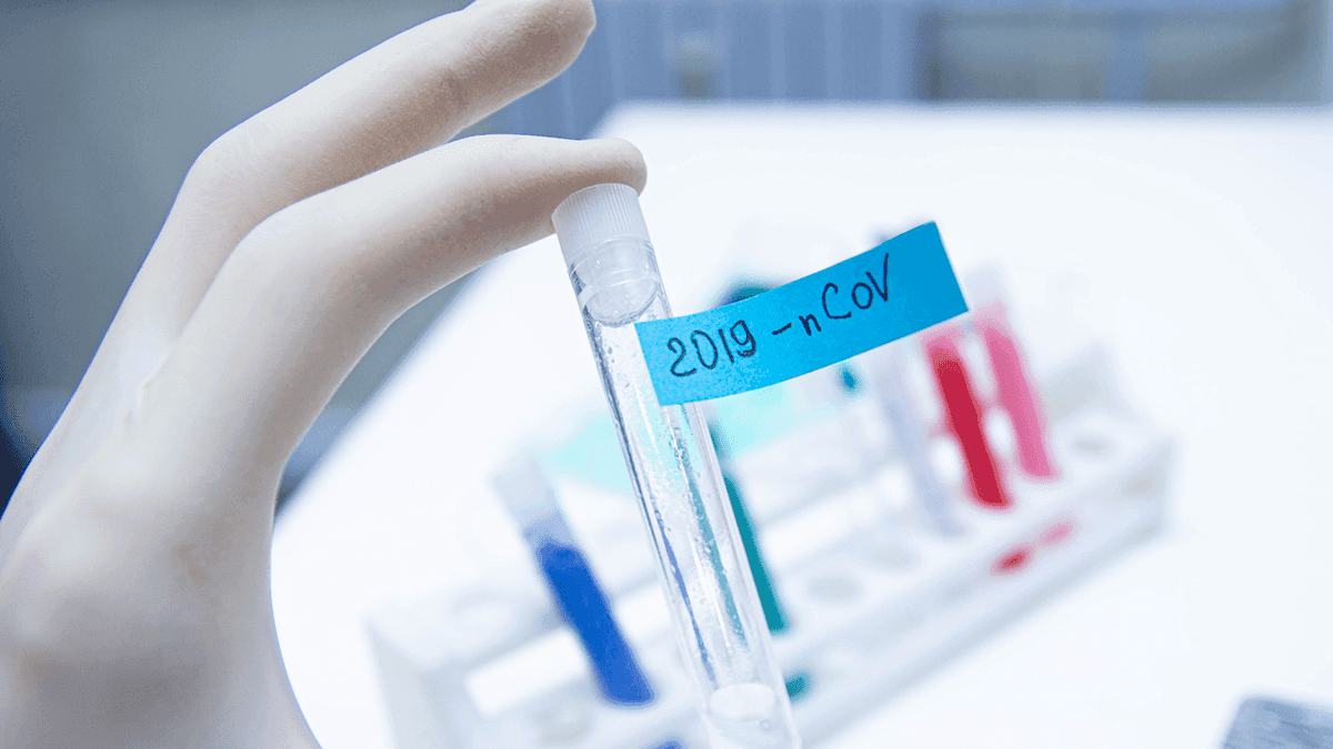 Coronavírus: Amurel tem 740 casos confirmados