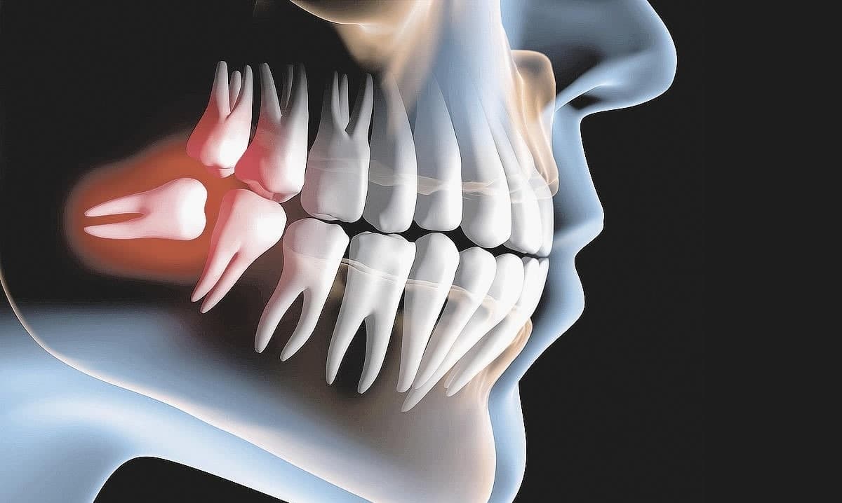 Doutor, preciso perder o “juízo”?