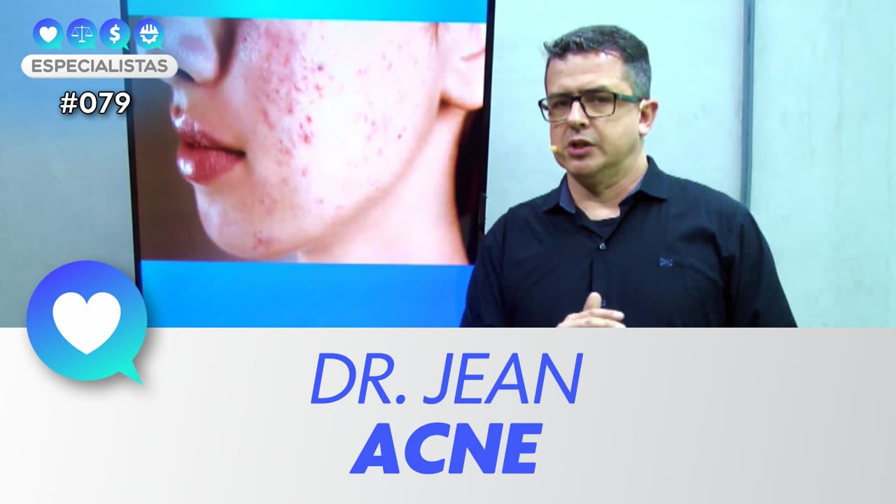 ASSISTA: Acne – Especialistas #079