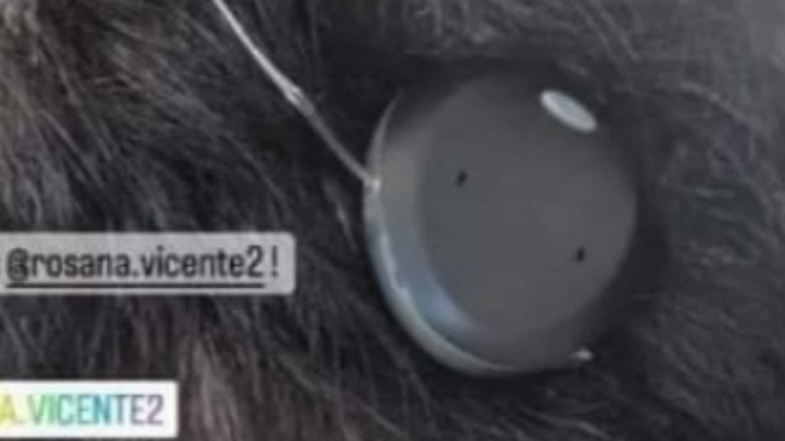 Filho perde aparelho auditivo de R$ 60 mil em Tubarão