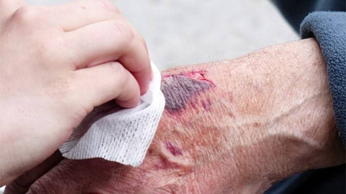 Idosa fica ferida durante assalto na rua