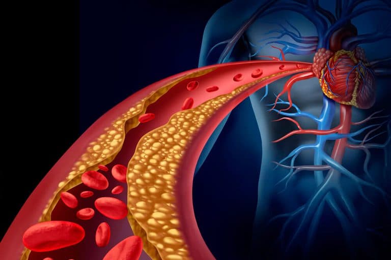 Colesterol: entenda um pouco mais