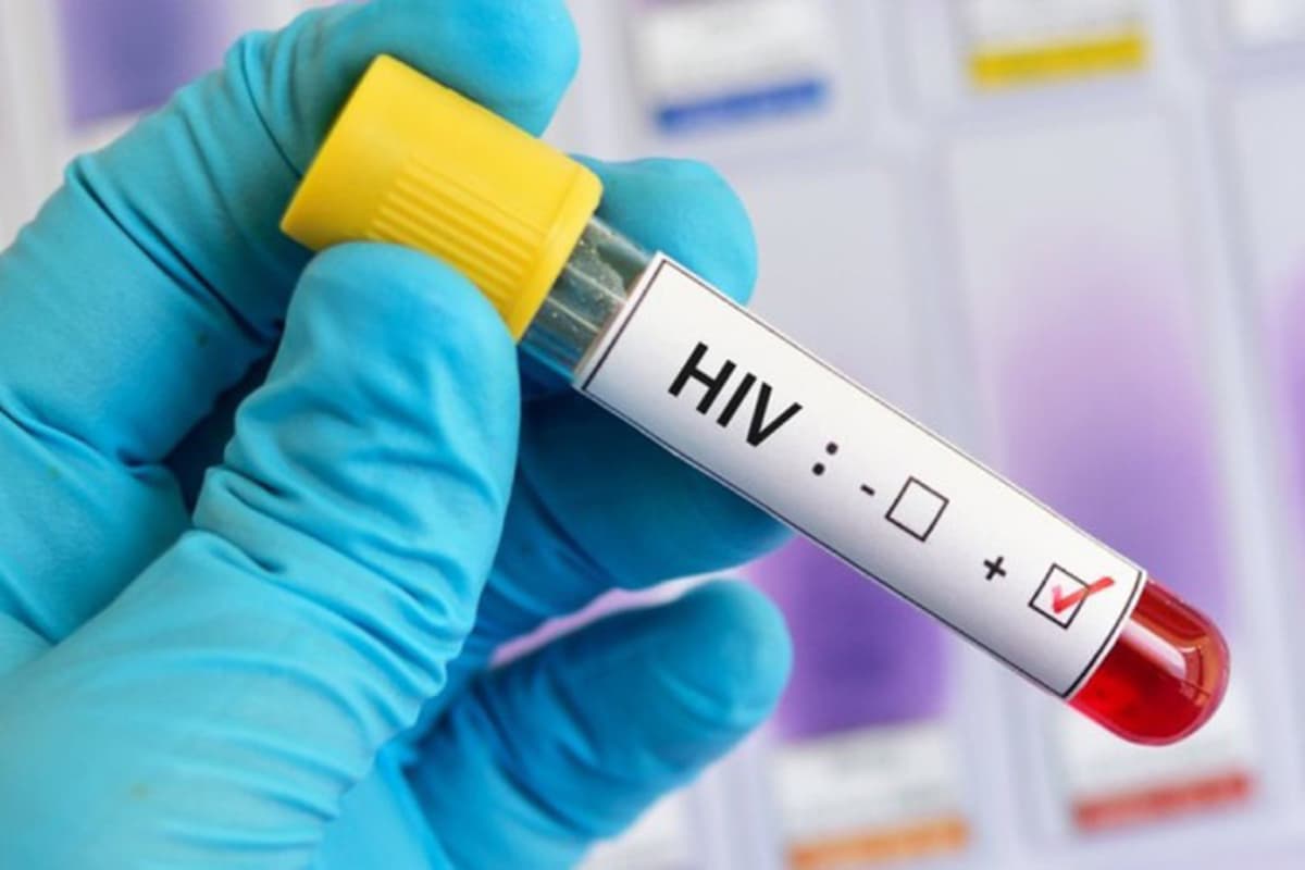Maior incidência de casos de HIV em Tubarão é na faixa etária entre 15 e 29 anos