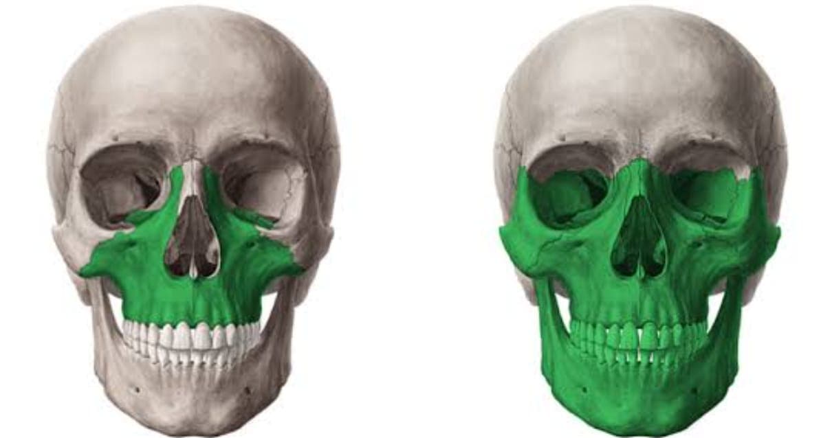 Reconstruções ósseas na odontologia e seus "poréns": o que você deve saber