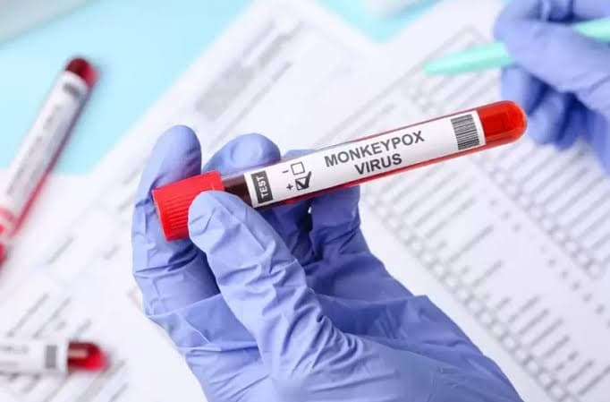 Diretor da OMS afirma que mpox não configura “uma nova Covid”