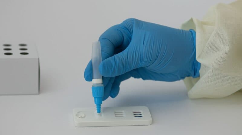 Unidades de saúde de Tubarão agora têm testes rápidos para detectar Covid e Influenza