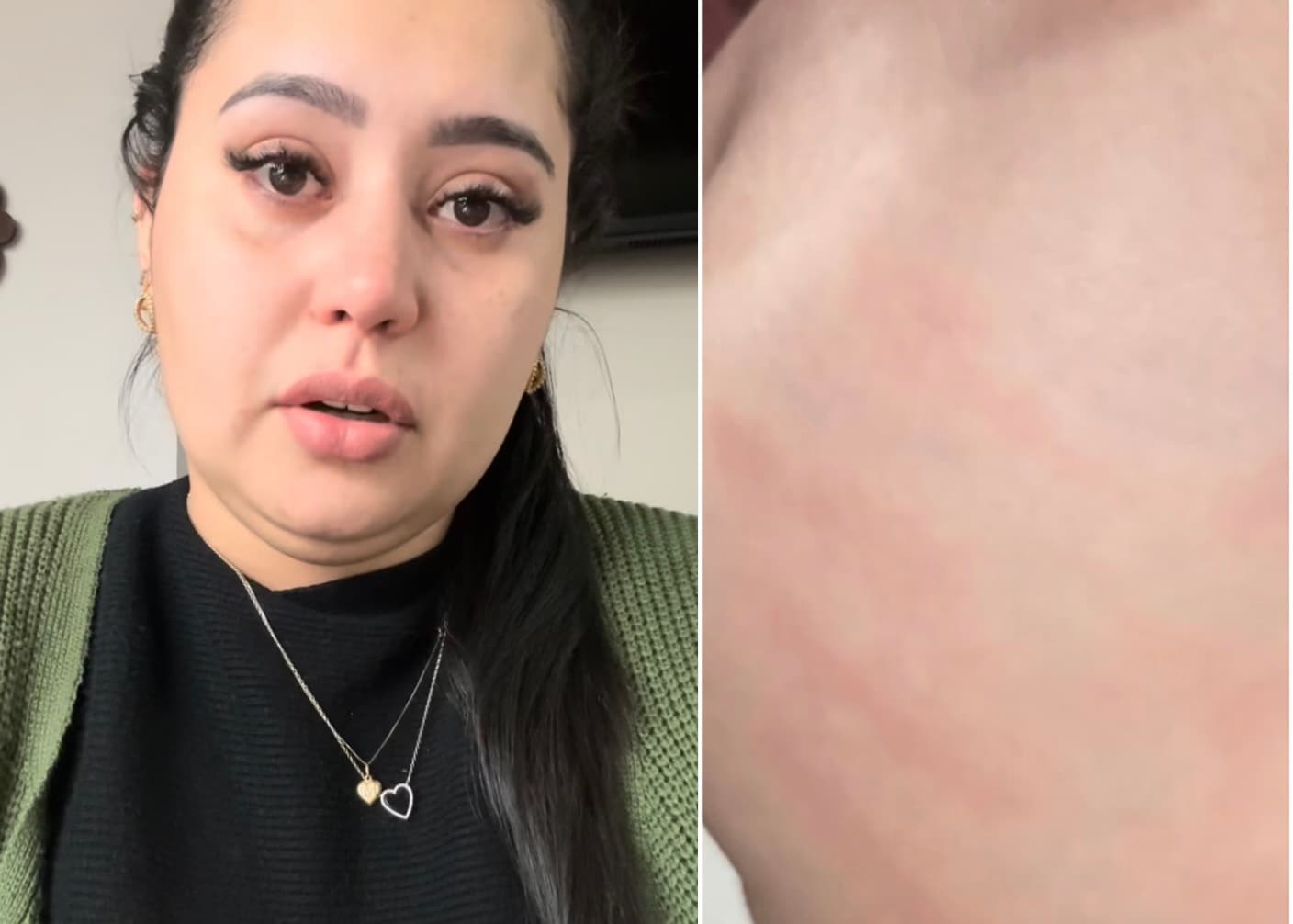 Mãe denuncia agressão de professora à filha de 1 ano na creche